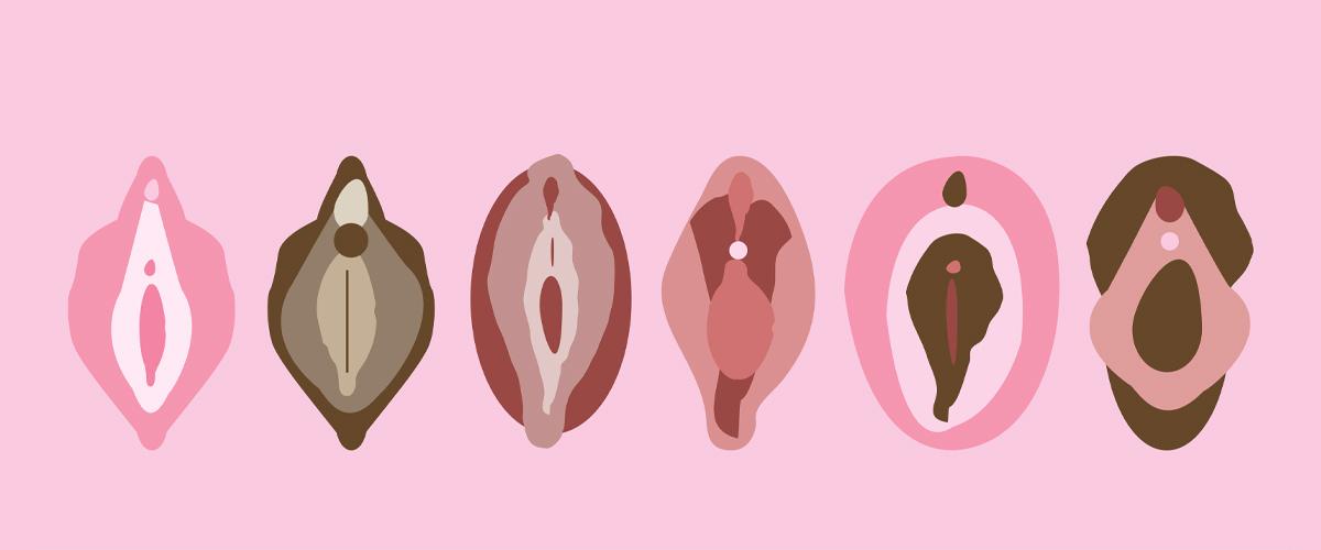 Labiaplasty (Vaginal Rejuvenation)