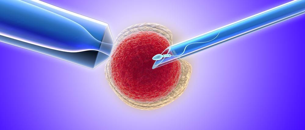 Intracytoplasmic Sperm Injection (ICSI)