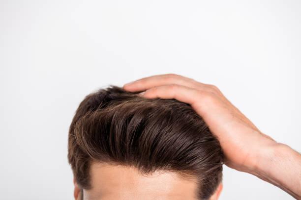 Hair Transplant vs. PRP Therapy