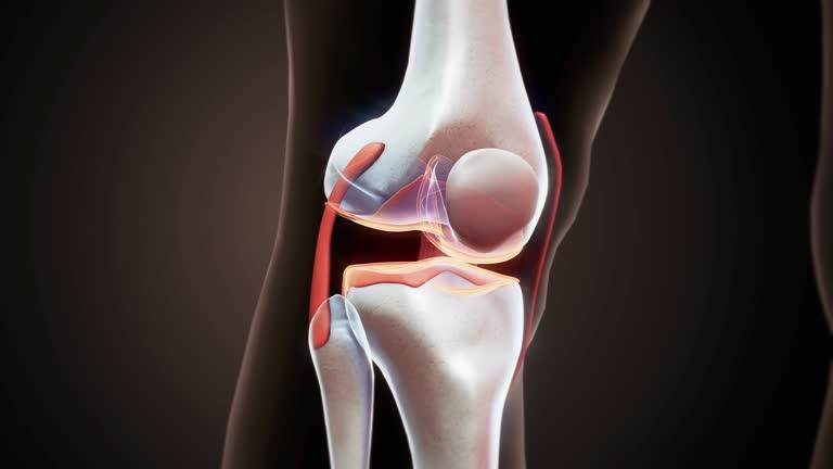 Partial vs. Total Knee Replacement