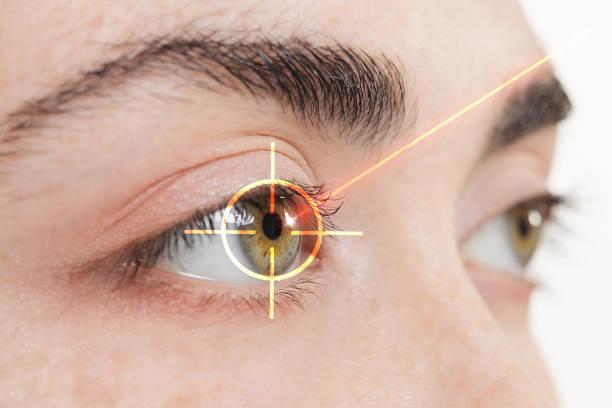 Different Types of Laser Eye Surgery