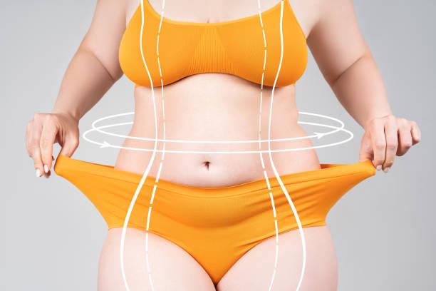 Liposuction Recovery & Tips