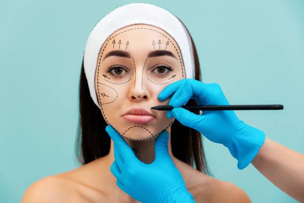 Risks of Blepharoplasty Surgery