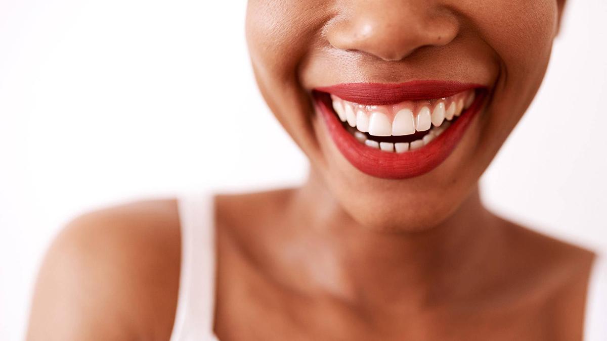 Different Methods of Teeth Whitening