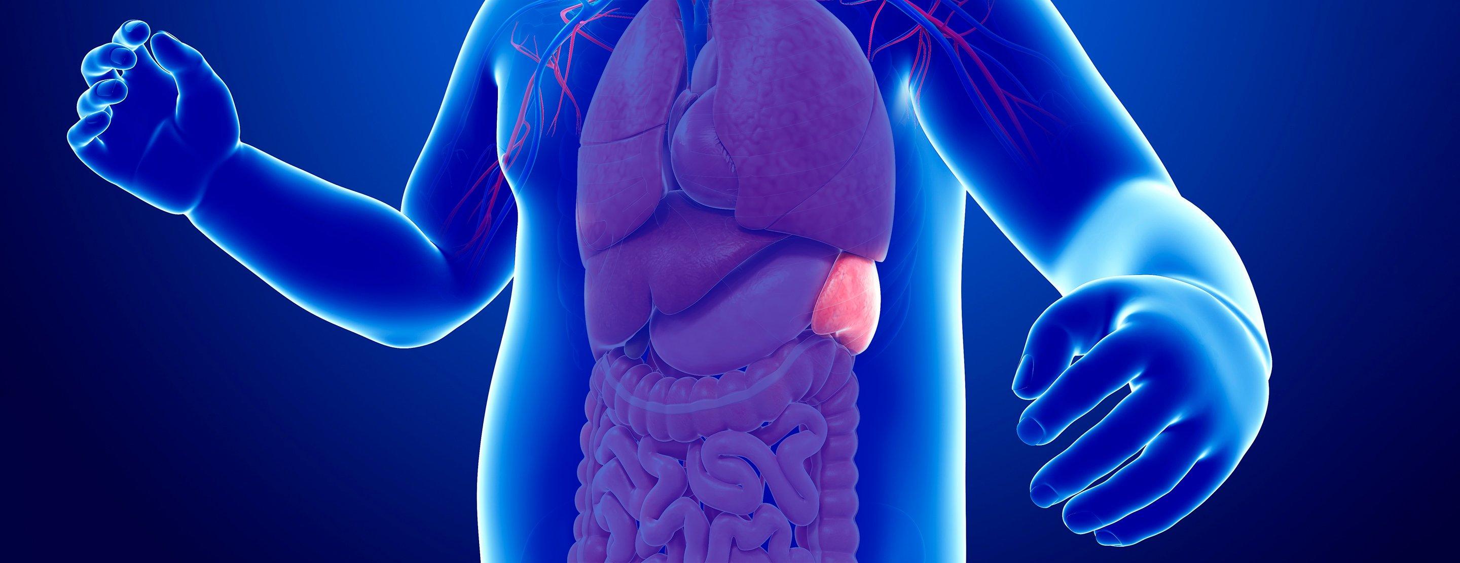 Splenectomy 