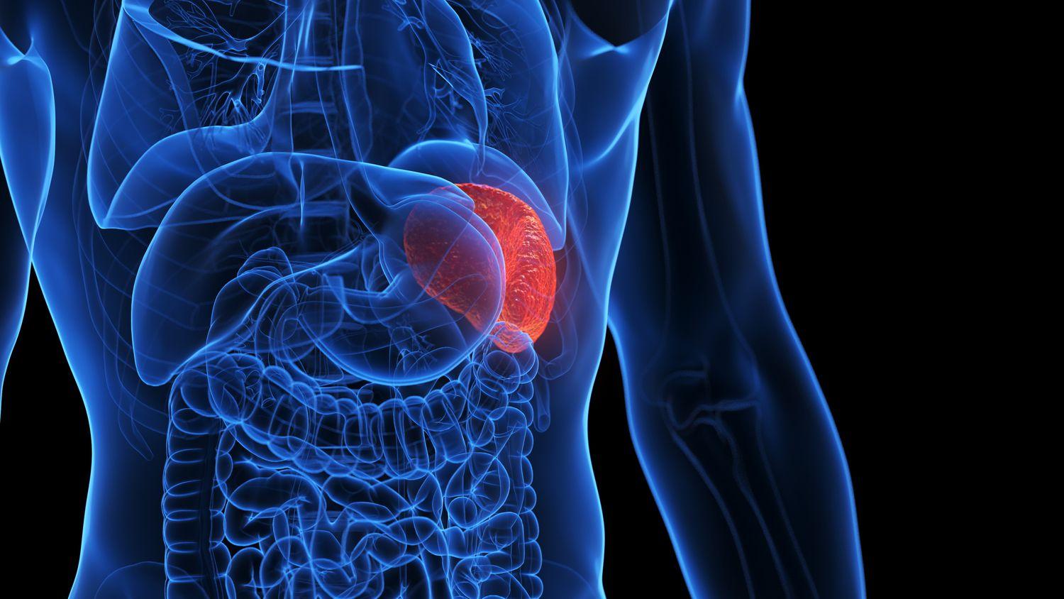 Why would I need to have my spleen removed?