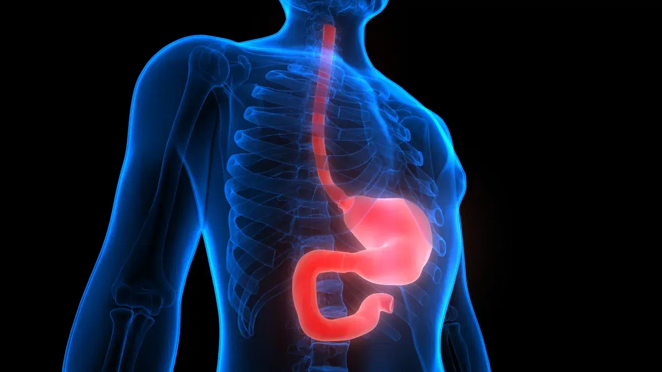 Esophagectomy Recovery