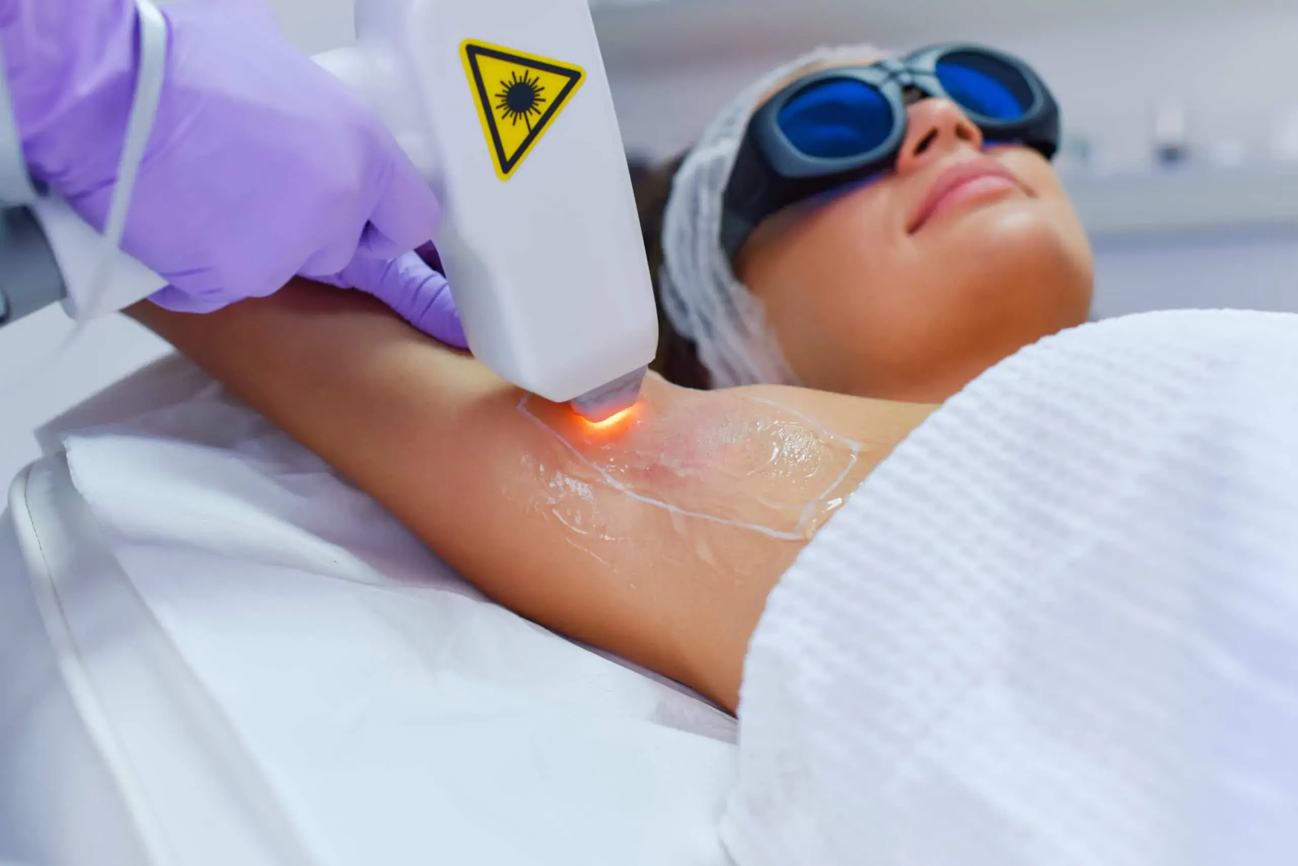 Laser Hair Removal: what you need to know