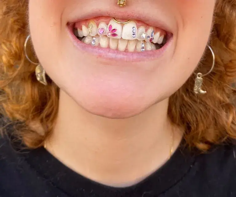 Tooth Jewelry