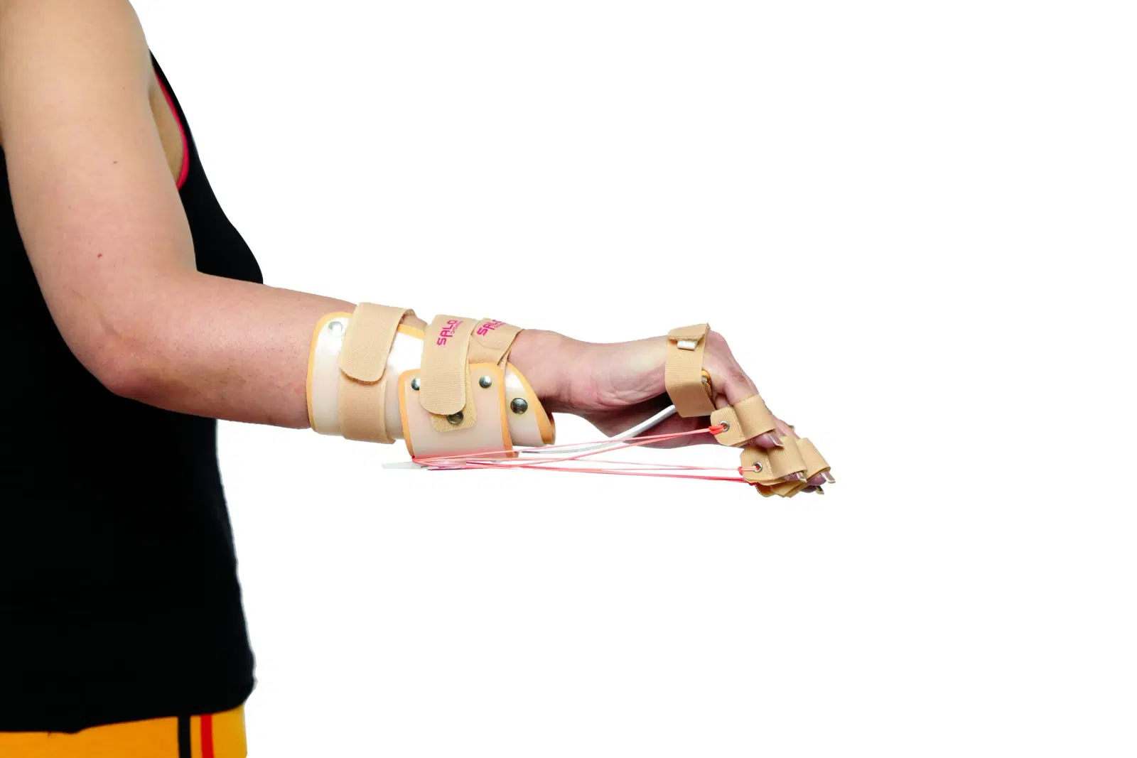 Radial Nerve Injury & Repair