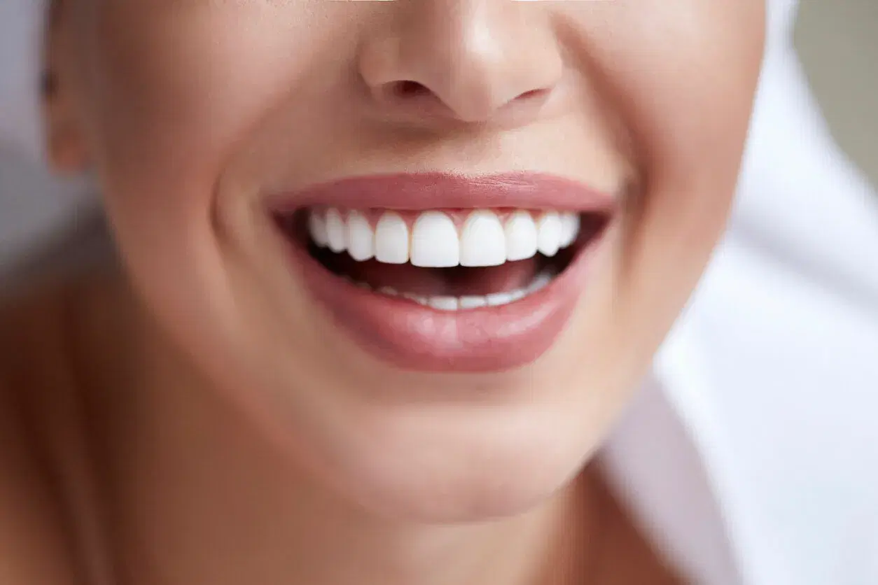 What are the types of Cosmetic Dentistry?