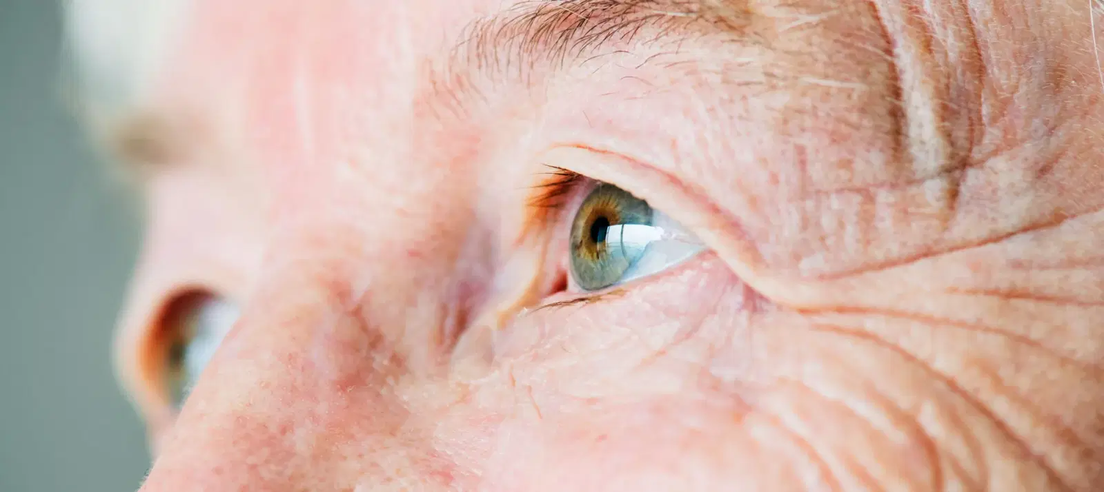 Why does Cataract occur?