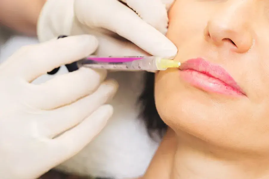 What are Dermal Fillers & how do they work?