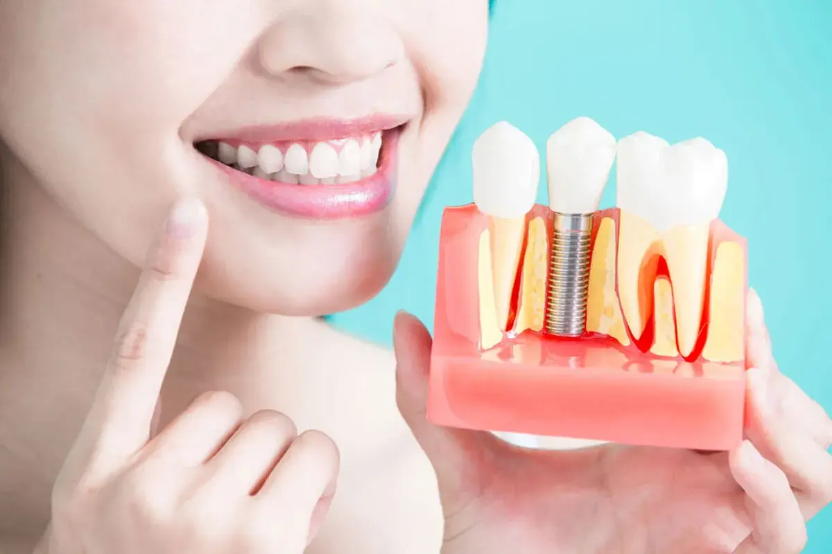 What are the pros of Dental Implant?