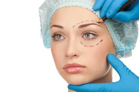 Blepharoplasty