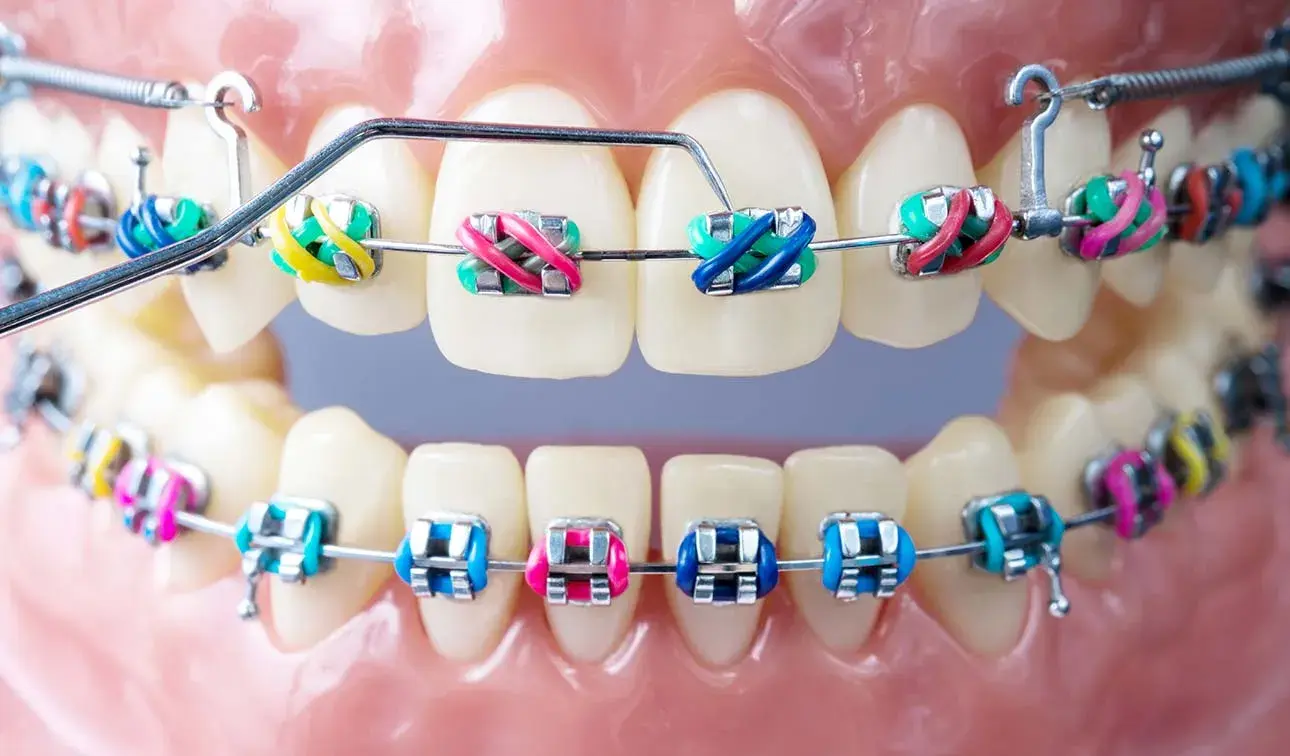 How does orthodontics work?