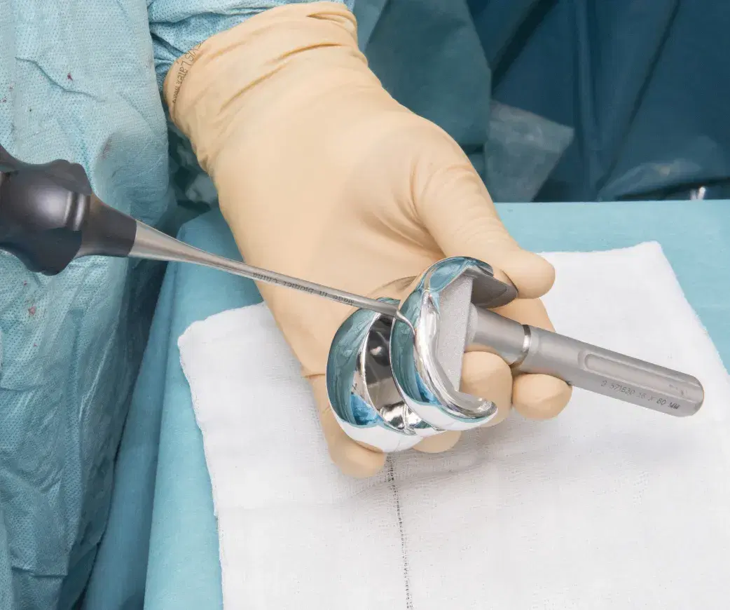 Types of Knee Replacement surgery