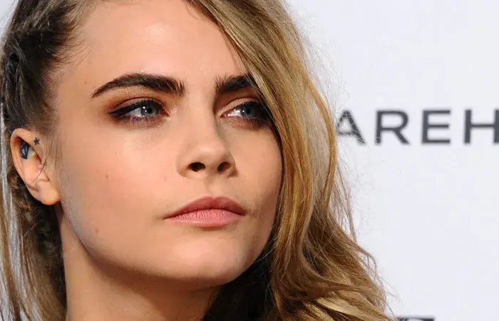 Is eyebrow transplant the new celebrity trend?