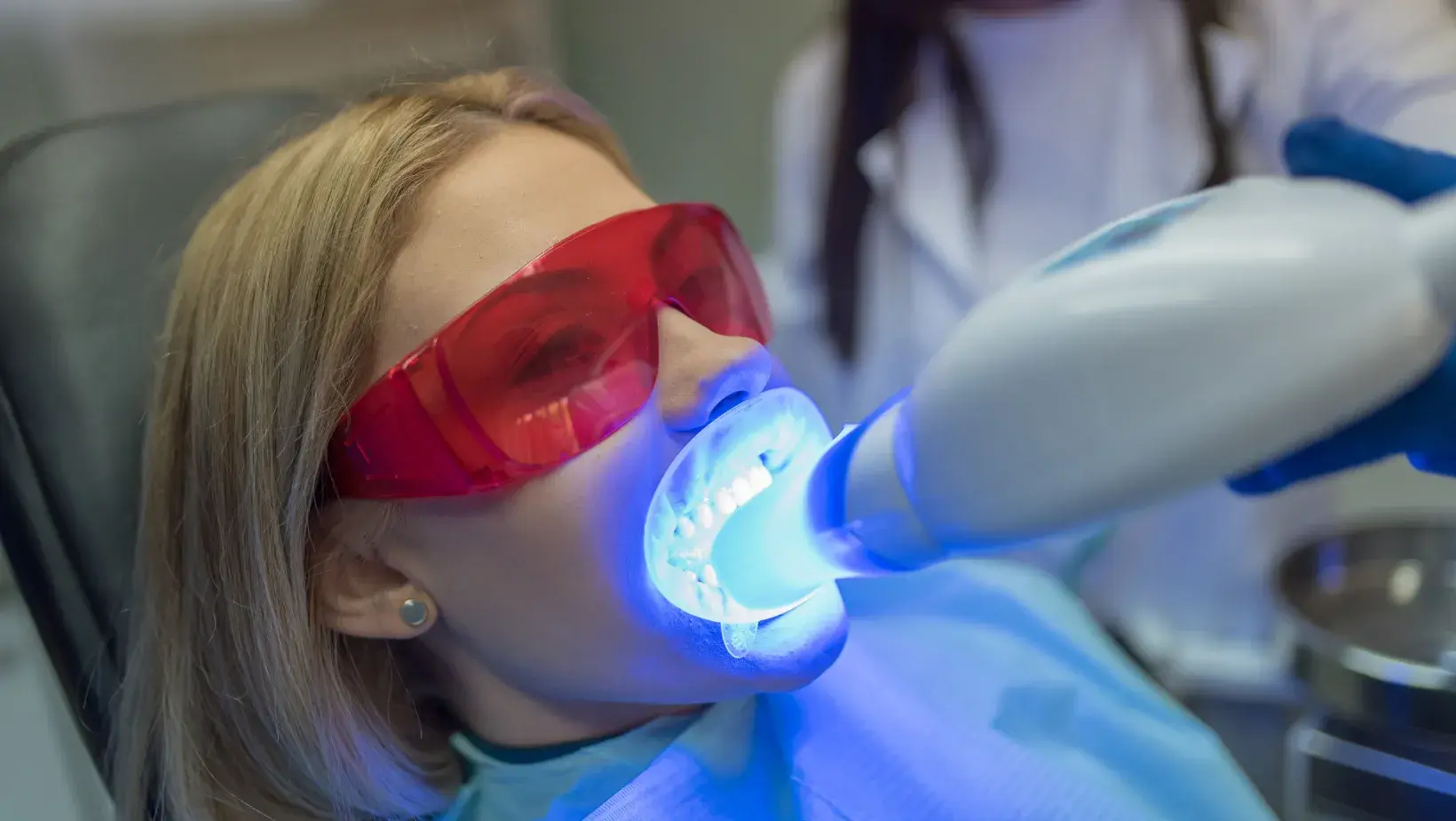 Teeth Whitening (Bleaching)