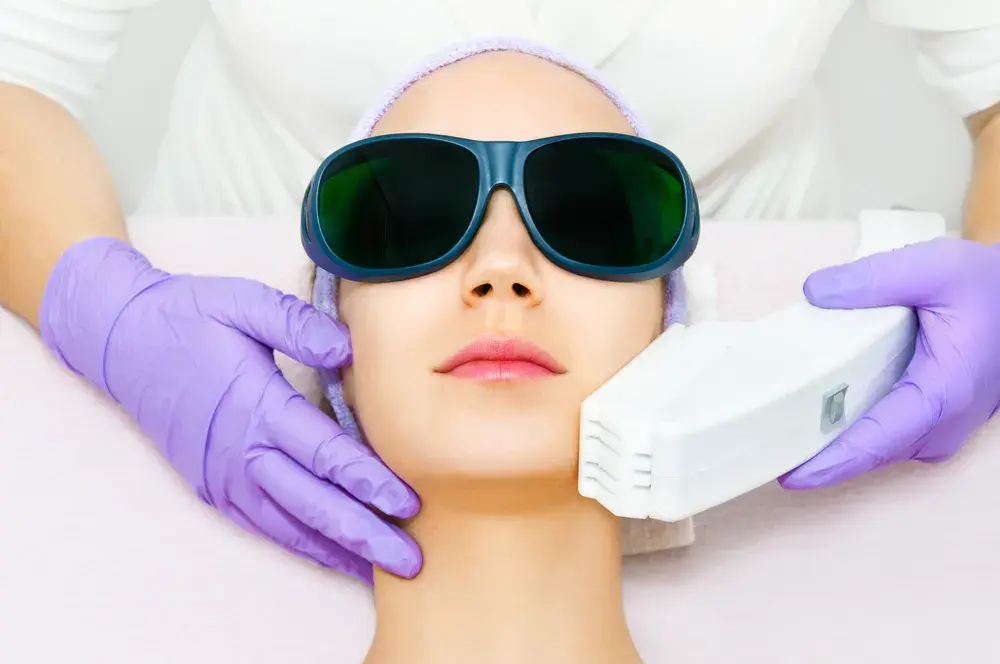 What is Laser Skin Resurfacing?