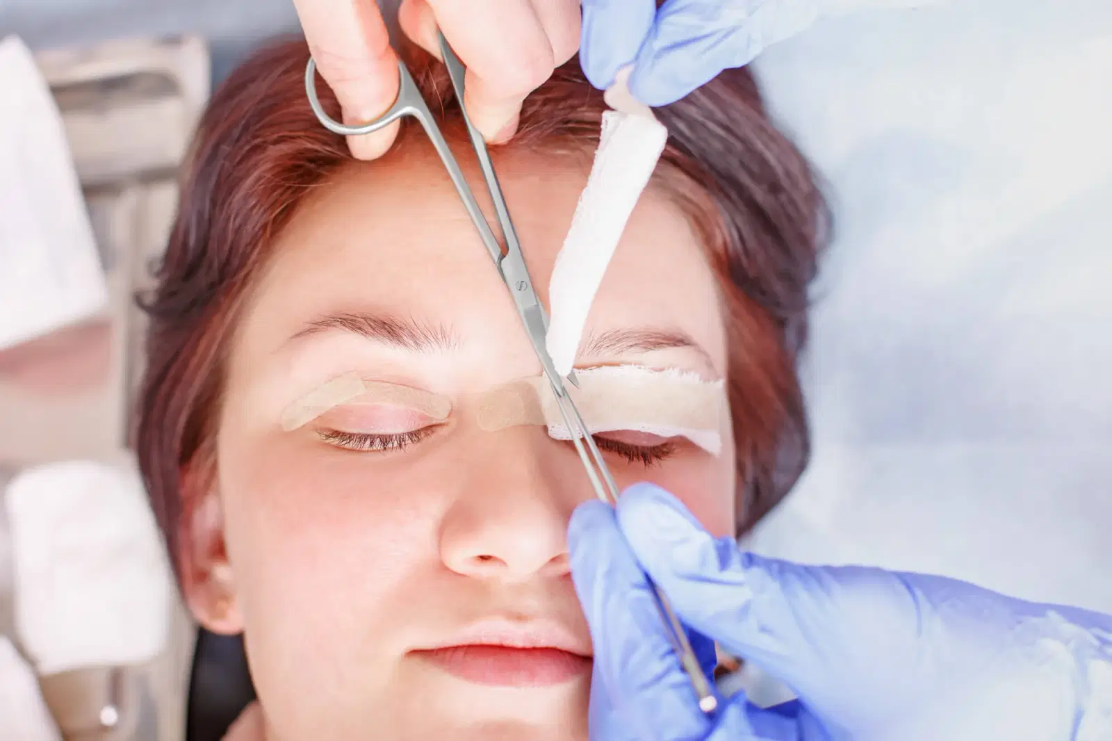 Role of Upper-Blepharoplasty in Facial Rejuvenation