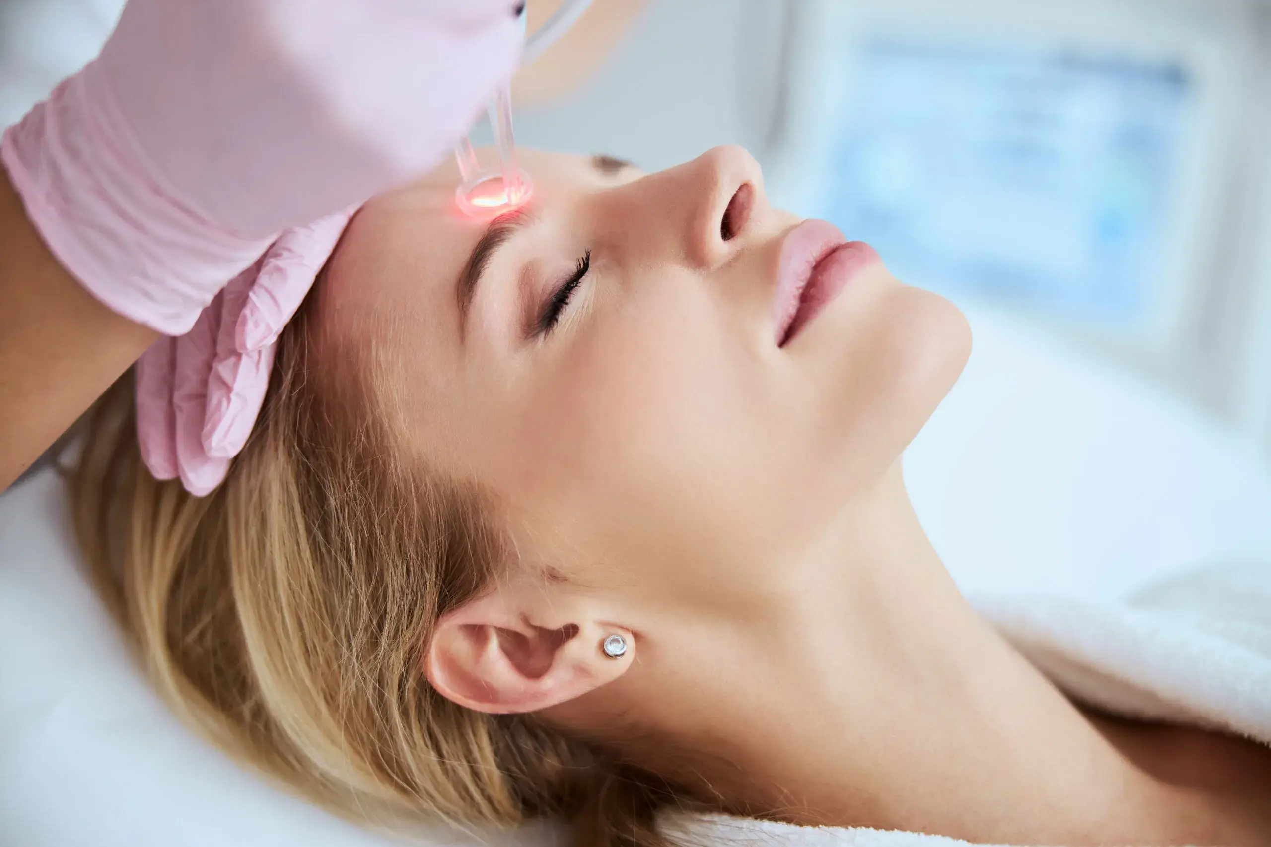 What is Laser Hair Removal?