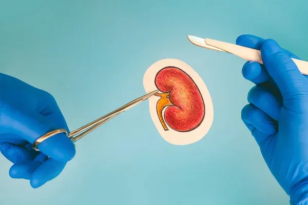 Signs of Kidney Transplant Rejection