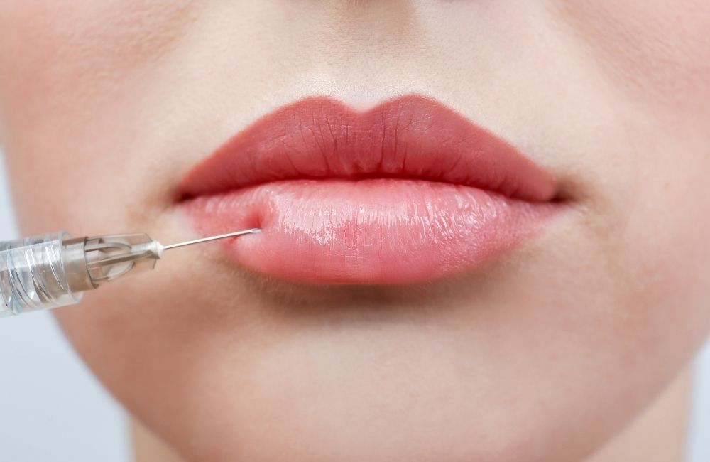 Different types of Lip Surgeries