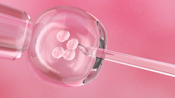 IVF Cost in Iran