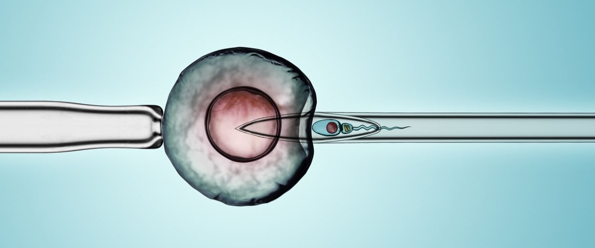 Intracytoplasmic Sperm Injection (ICSI) in Iran