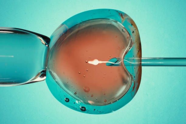 Intracytoplasmic Sperm Injection (ICSI) in Iran