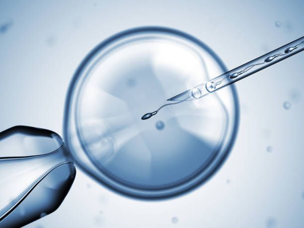 Intracytoplasmic Sperm Injection (ICSI) in Iran