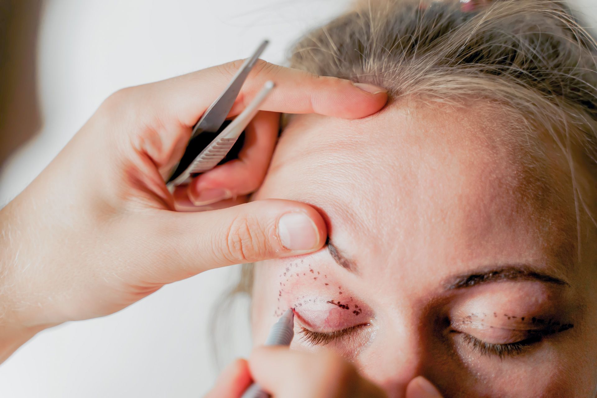 Ptosis Repair Surgery Vs. Blepharoplasty