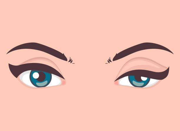 Ptosis Repair Surgery Vs. Blepharoplasty