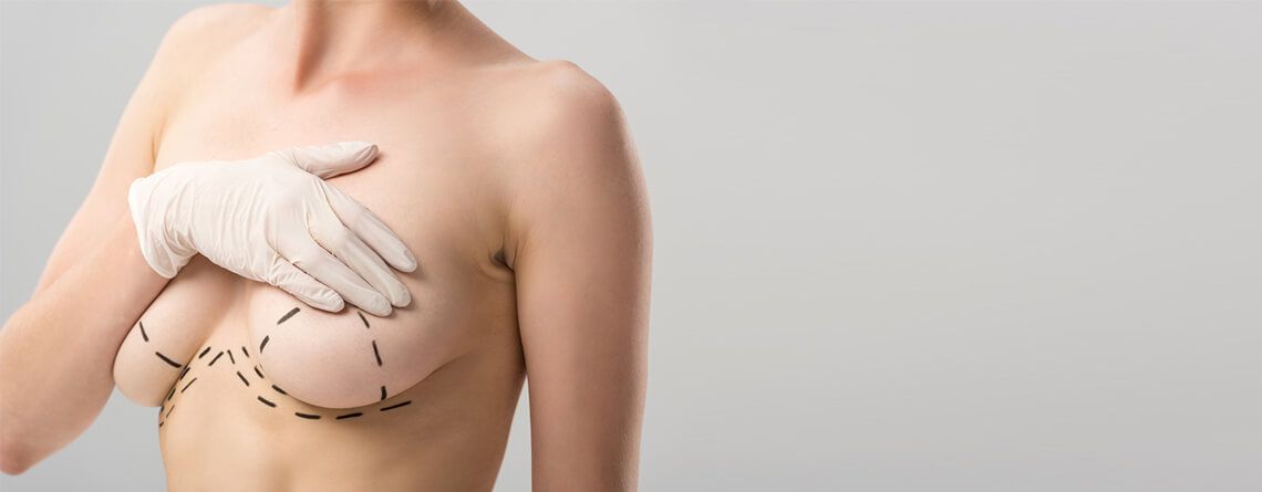 Mammaplasty vs. Mastectomy