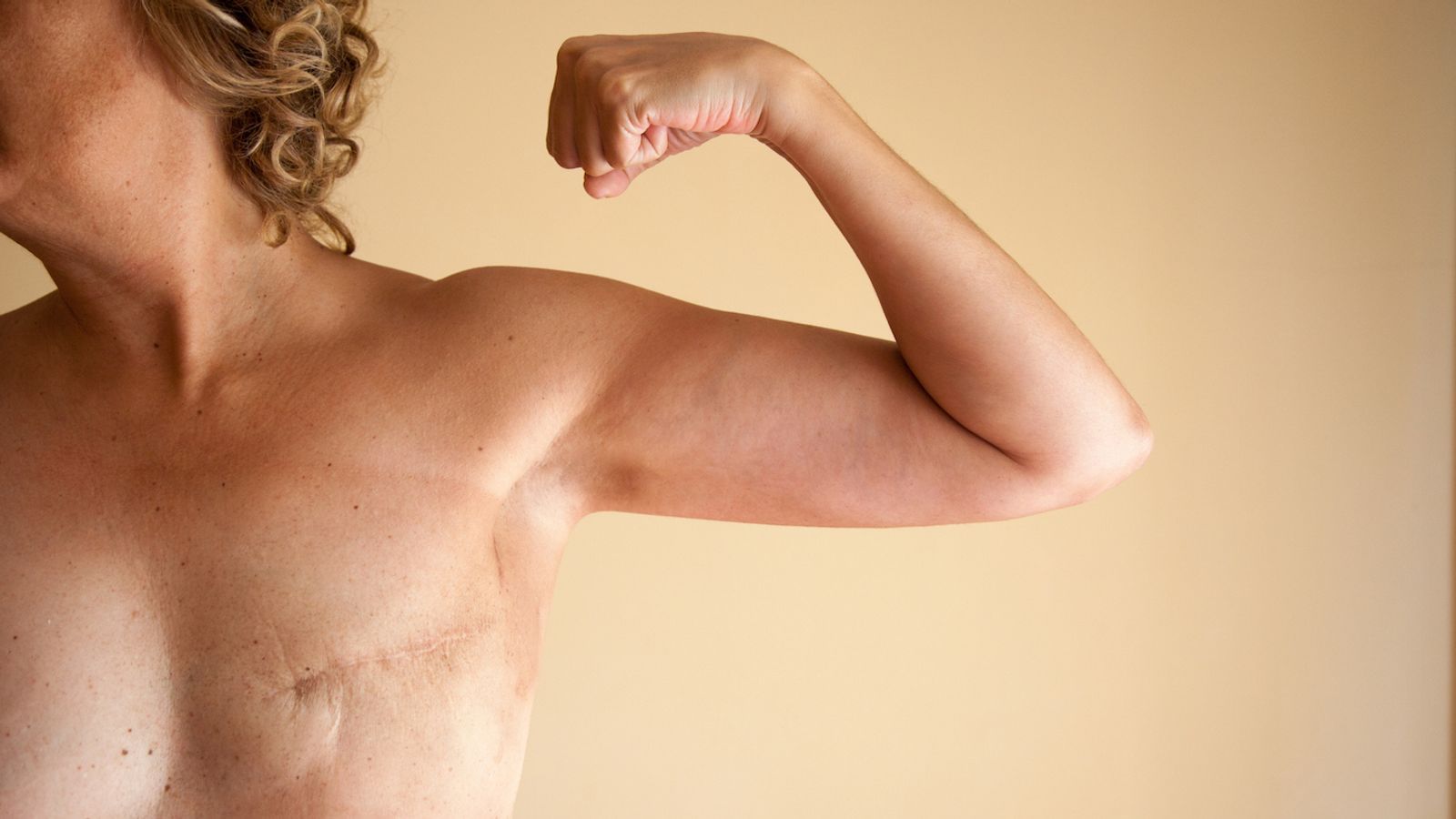 Mammaplasty vs. Mastectomy