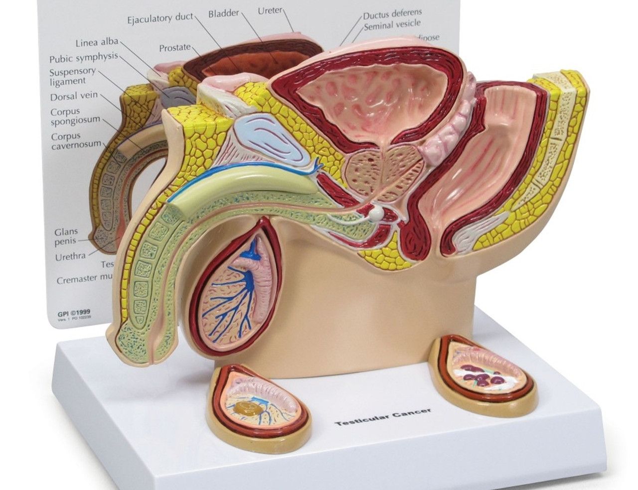 What is Testicular Cancer? 