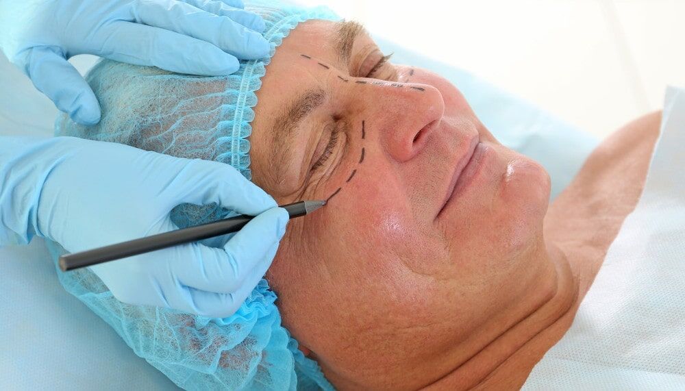 Filler vs. Blepharoplasty