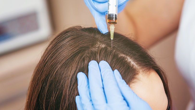 Risks of Hair Filler Injections