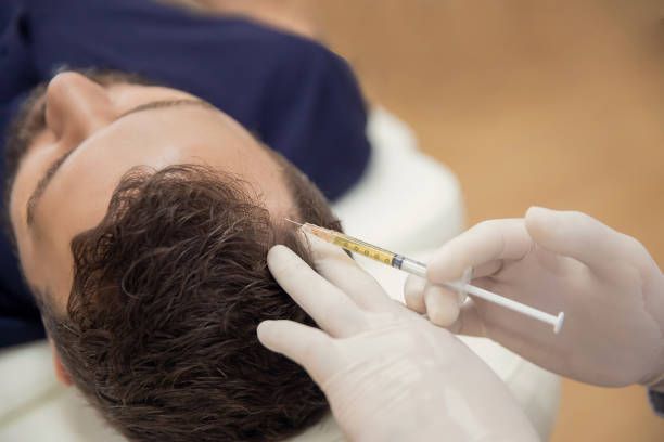 Risks of Hair Filler Injections