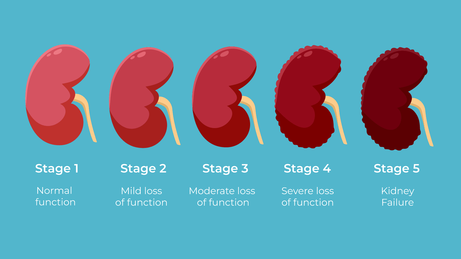 Signs of Kidney Failure