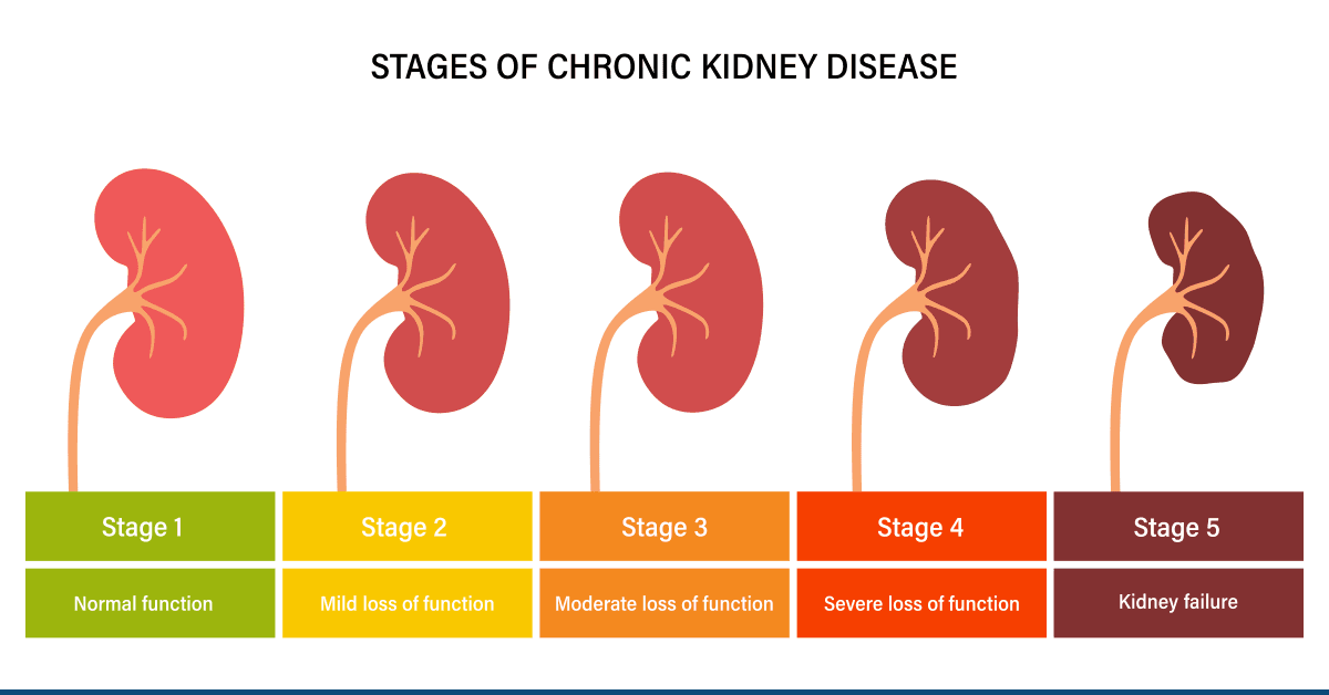 Signs of Kidney Failure 6