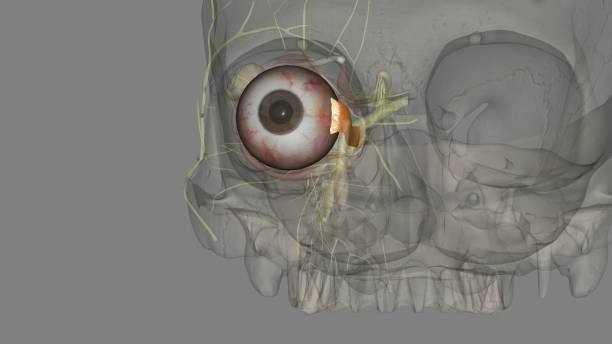 Cornea Transplant in Iran