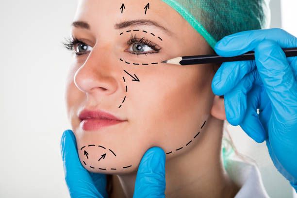  Technique Differences between full facelift and mini facelift