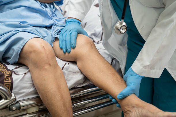 The Difference Between Partial and Total Knee Replacements