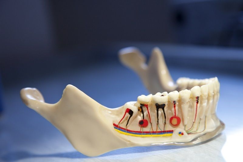 What is root canal treatment?