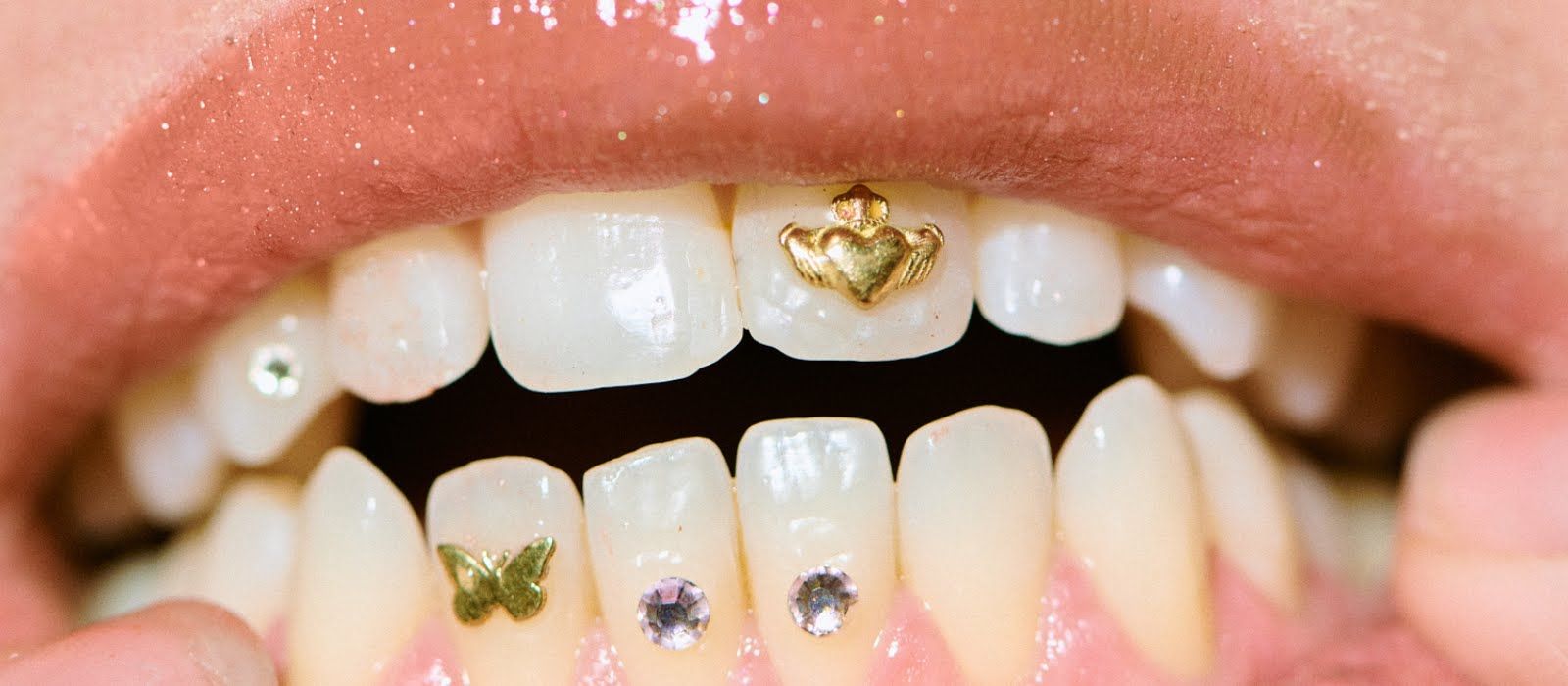 Pros and cons of tooth gems