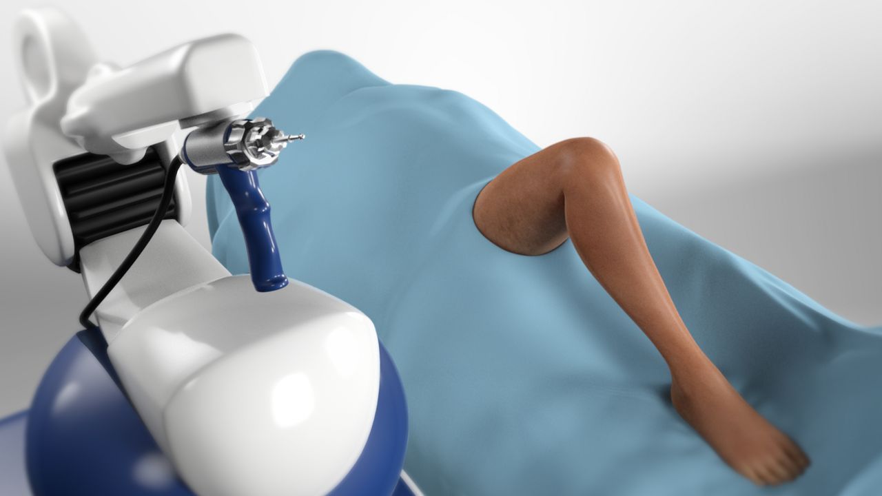 What is Robotic Knee Replacement?