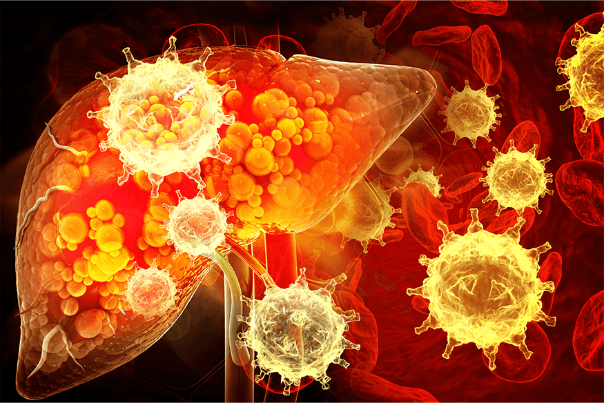 Signs of Liver rejection after transplant