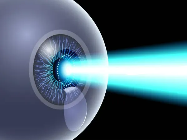 What is LASIK?